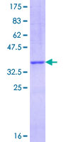12.5% SDS-PAGE Stained with Coomassie Blue.